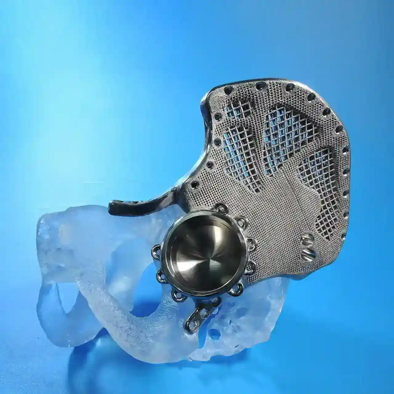 3d printed pelvis
