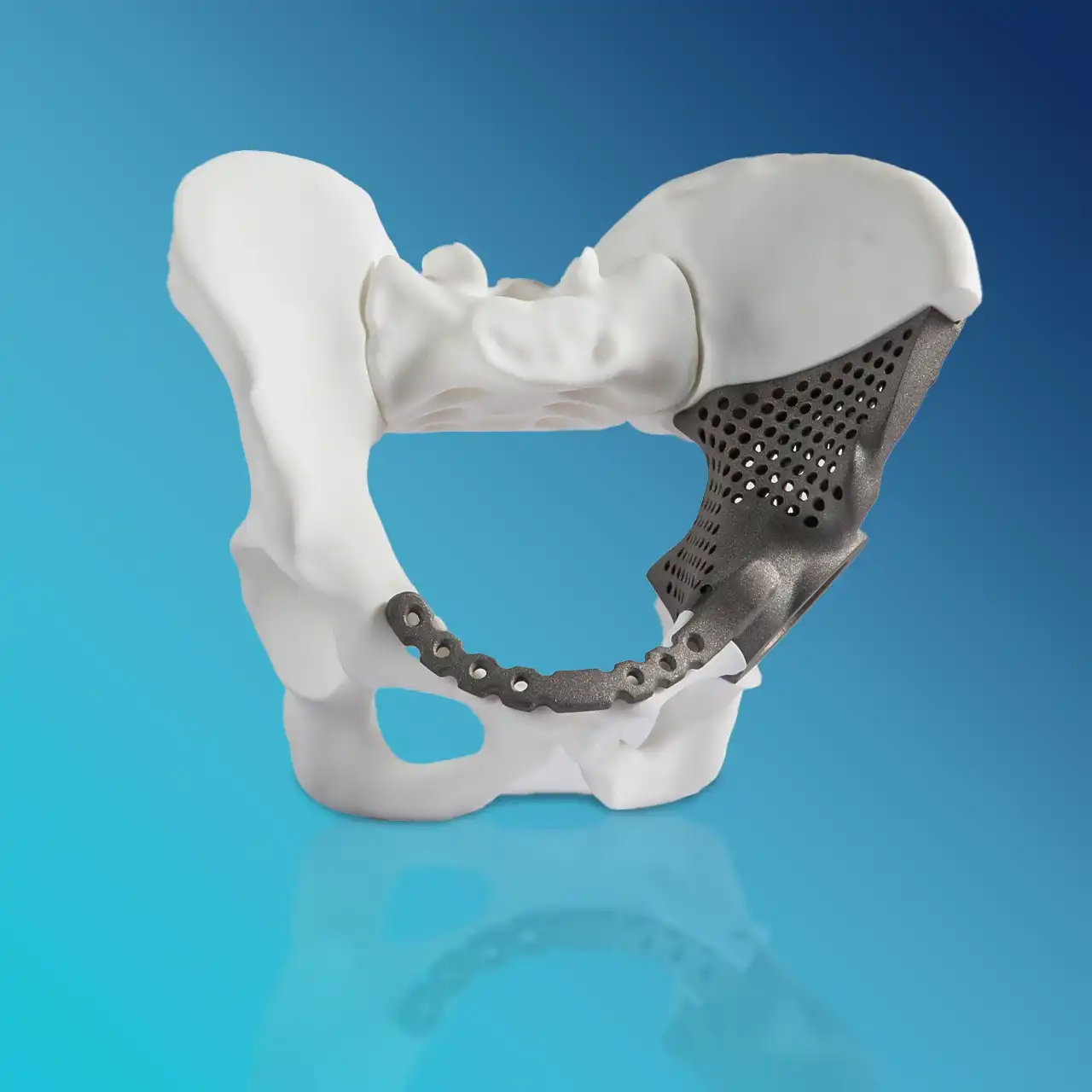 3d printing medical prosthetics