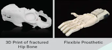 3d-printed-medical-parts