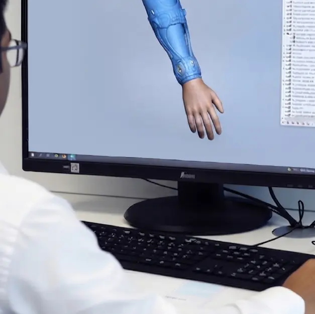 3D CAD Reconstruction for Medical Implants